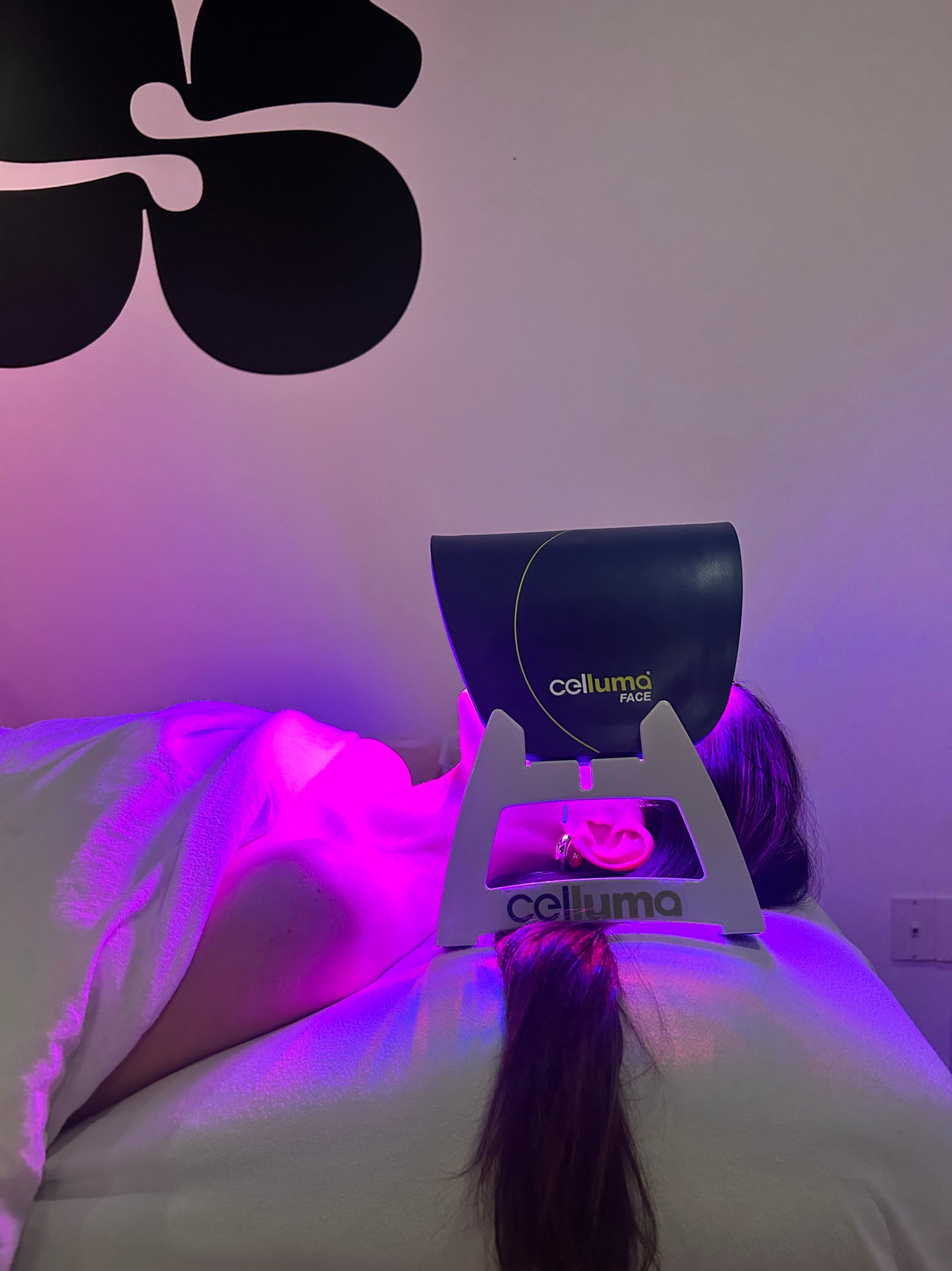 Acu Glow | Cosmetic acupuncture